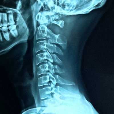 X-Ray